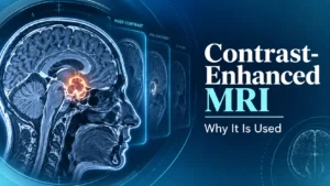 Contrast-enhanced MRI for brain tumor evaluation