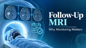 Follow-up MRI monitoring after Gamma Knife treatment