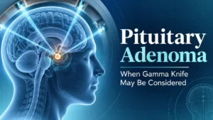 Gamma Knife treatment illustration for pituitary adenoma