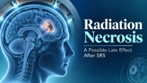 Radiation necrosis after stereotactic radiosurgery illustration
