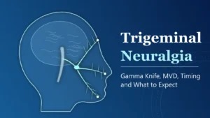 Abstract illustration of trigeminal nerve branches on a head profile, with the title Trigeminal Neuralgia